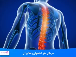 سرطان مغز استخوان وعلائم آن