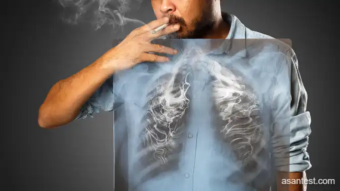 احتمال ابتلا به سرطان ریه در افراد سیگاری بیشتر است